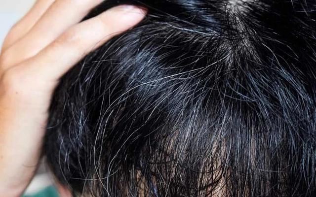 How To Reverse Premature Grey Hair Naturally | Inspiration  FM
