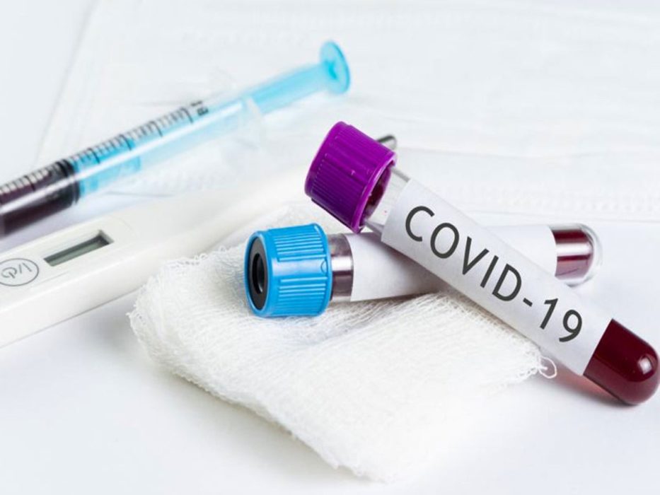 Nigeria Records 594 New Covid-19 Cases