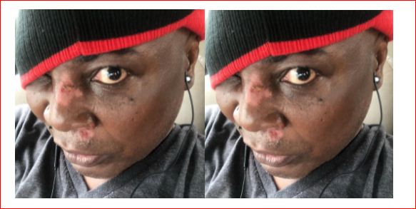 Charly Boy Sustains Injuries After Falling Off His Scooter