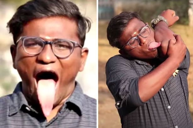 Meet Man With ‘World’s Longest Tongue’ Who Can Lick Elbow