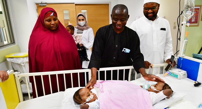 Saudi Medical Team Seperates Conjoined Twins From Nigeria